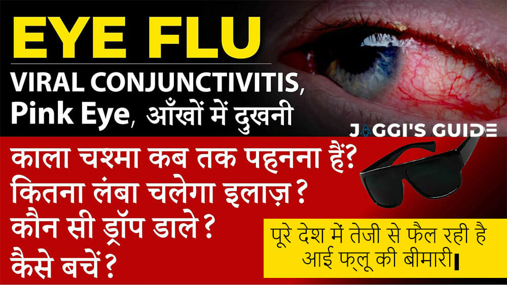 Eye-Flu-Conjunctivitis-jaggis-guide